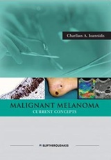 Malignant Melanoma Current Concepts